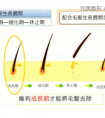 南京做以色列SHR冰点脱毛优势?