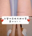 手臂冰点脱毛的优势是什么?半永久?