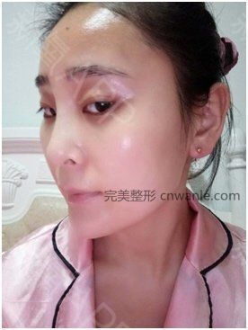 术后当自强