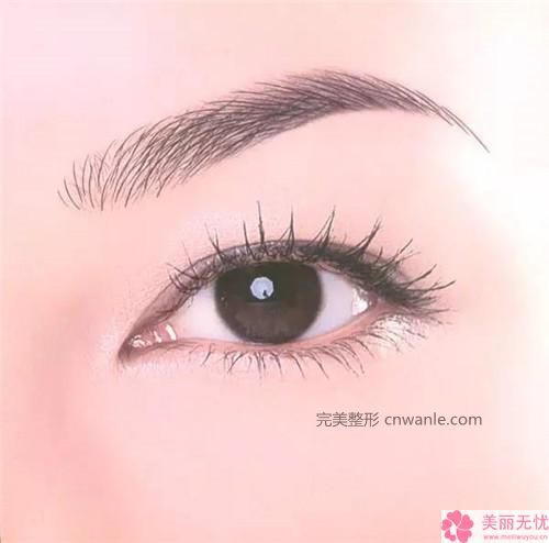 半永久纹发际线的优缺点