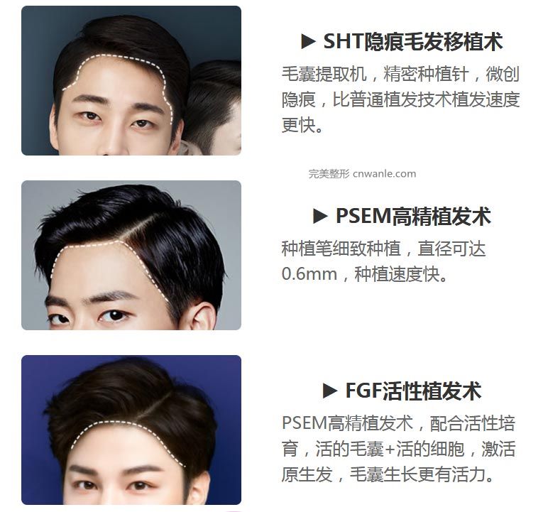 上海做半长久发际线做韩式的多少钱