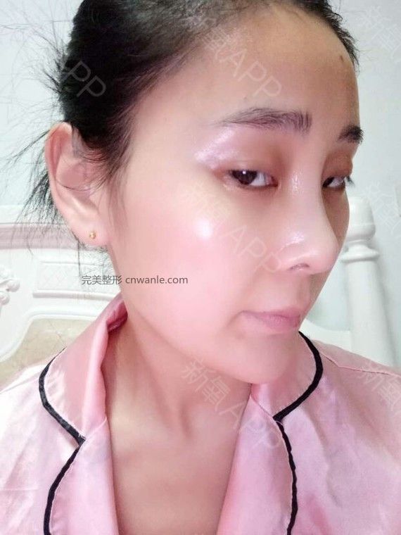 术后当自强