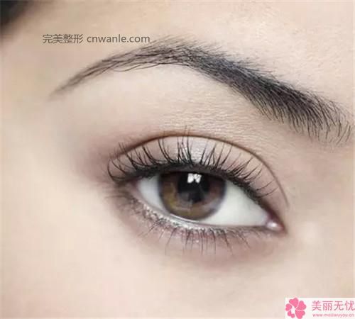 半永久纹发际线优势_半永久纹发际线的优势是什么