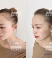 江苏学发际线技术