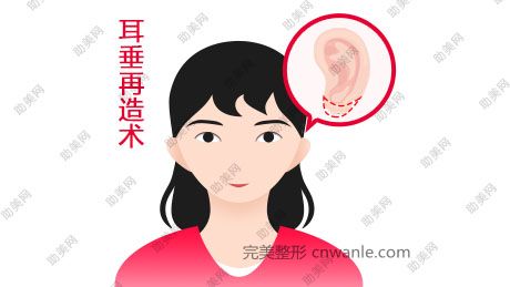 武汉春语玻尿酸丰耳垂优势有哪些？
