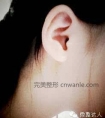 玻尿酸丰耳垂多少钱的方法有哪些效果方式如何影响因素