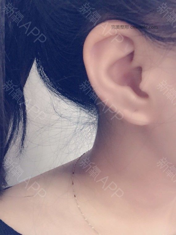 术后当自强 术后当自强