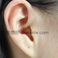 耳垂太小怎么办