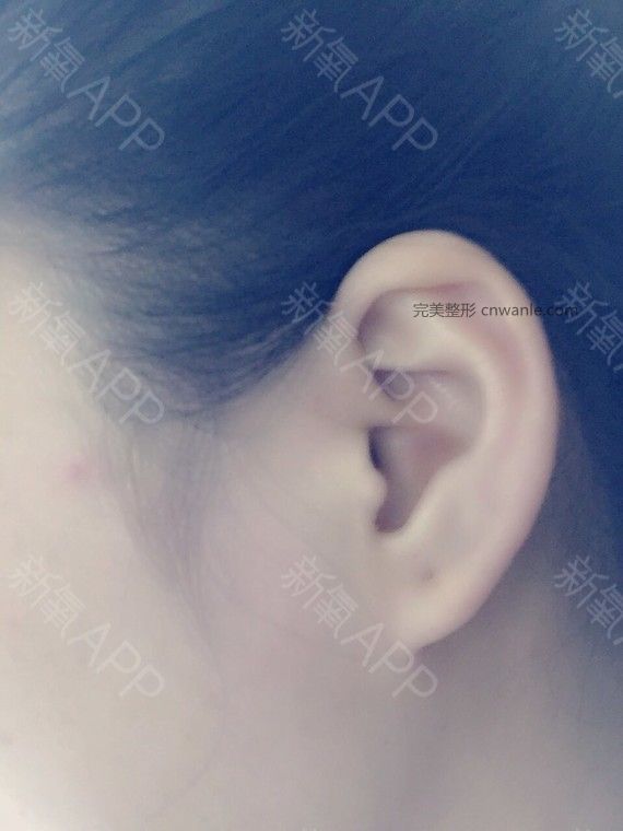 术后当自强 术后当自强