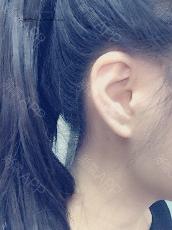 术后当自强 术后当自强