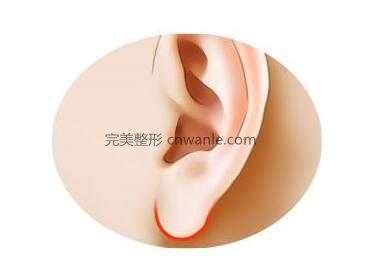 北京<a href='/tag_yixingzhengxing.html'>艺星整形</a>医院