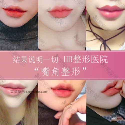 HB整形医院官网案例 HB整形医院官网案例