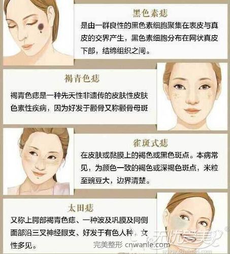 各种斑点的产生