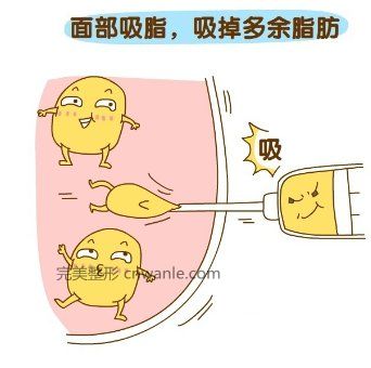 吸脂瘦脸效果怎样