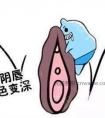 韩式阴唇漂红也不如小阴唇整形手术效果好!爱美的女性