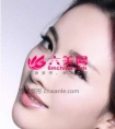 几种常见鼻尖整形术的手术方法介绍