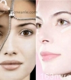 激光祛斑后遗症 时刻注意美容副作用