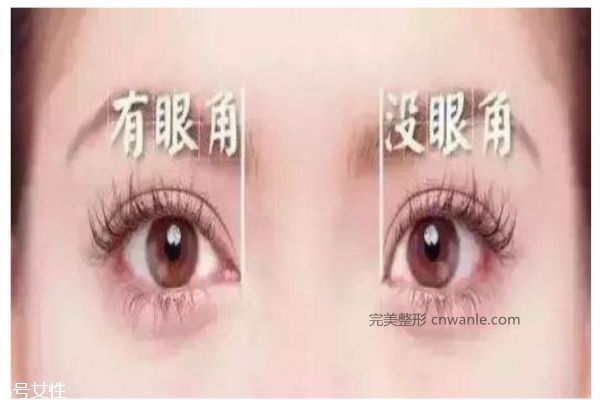 开眼角的好处是什么呢 开眼角需要注意什么呢