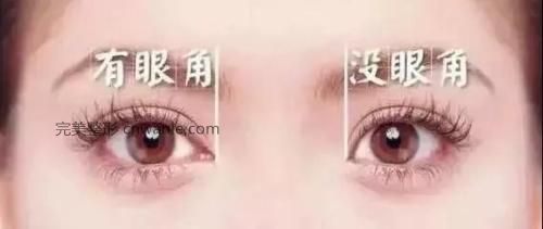 开内眼角除了让眼睛变大还有哪些好处
