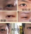5分钟带你认识眼睛问题和变美方法