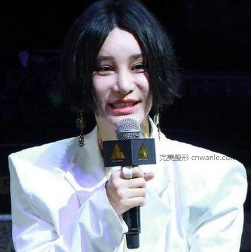 24岁超女整容殒命，江映蓉整成鬼，她整成男人，她穿裙子困难？