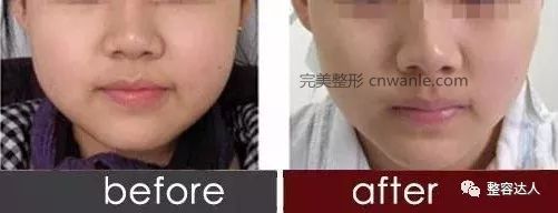 对比