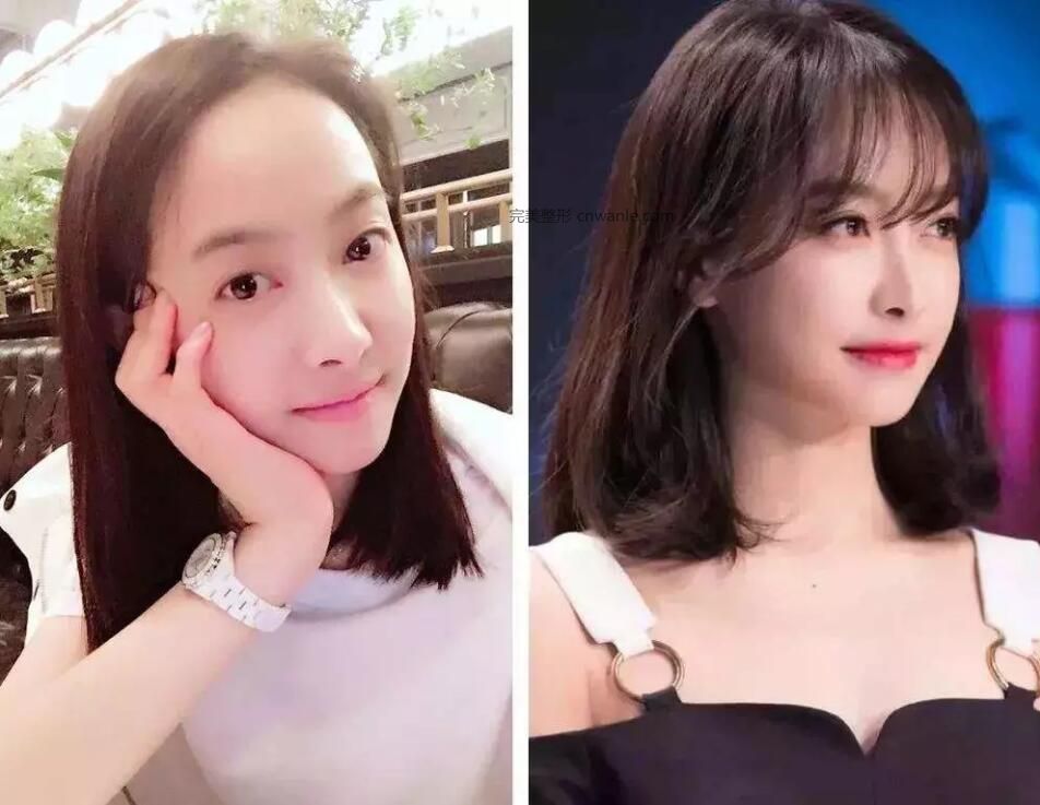 1569385415511679.jpg 4.jpg