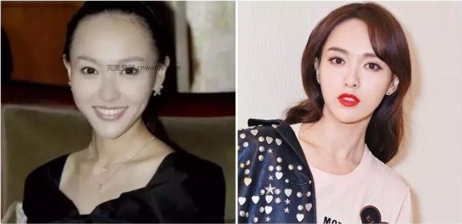 1569385432117978.jpg 5.jpg