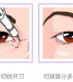 开眼角和不开的区别图