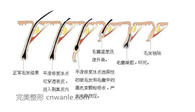 <a href='/tag_tuochunmao.html'>脱唇毛</a>