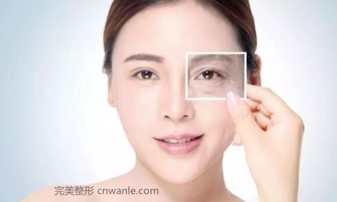 电波拉皮？是个什么鬼