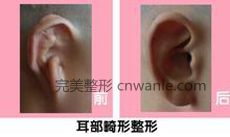 手术方式