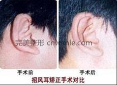 概述