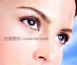 开眼角手术多久可以恢复？