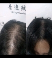 半永久纹发际线好不好到底
