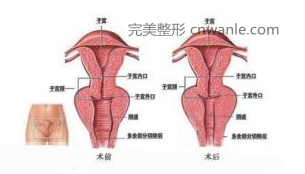 阴道紧缩术