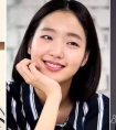 单眼皮变双眼皮真的能使人变好看吗