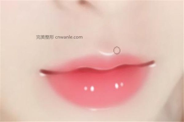 嘴角上扬手术后悔了怎么办 嘴角上扬手术失败