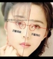 做个双眼皮眼睛会变大吗?不开眼角能变理想效果吗?