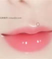 嘴角上扬手术后悔了怎么办 嘴角上扬手术失败