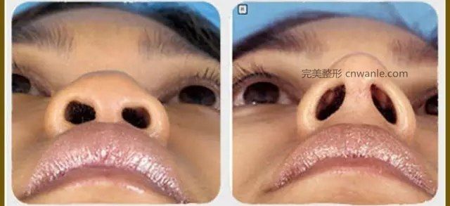 暂无