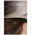 半永玖纹发际线效果自然吗