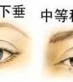 割双眼皮开内眼角,有必要提肌吗,提肌有风险没?