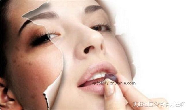 点击图片查看幻灯模式