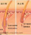 南通冰点脱毛有什么优势?