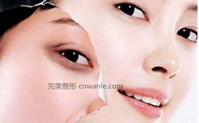 电波拉皮和超声刀有什么区别，有没有后遗症？