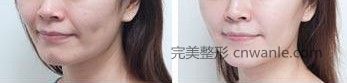 电波<a href='/tag_lapi2.html'>拉皮</a>