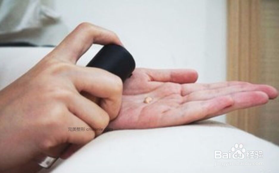 刚纹的发际线怎样去掉