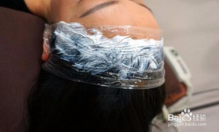 刚纹的发际线怎样去掉