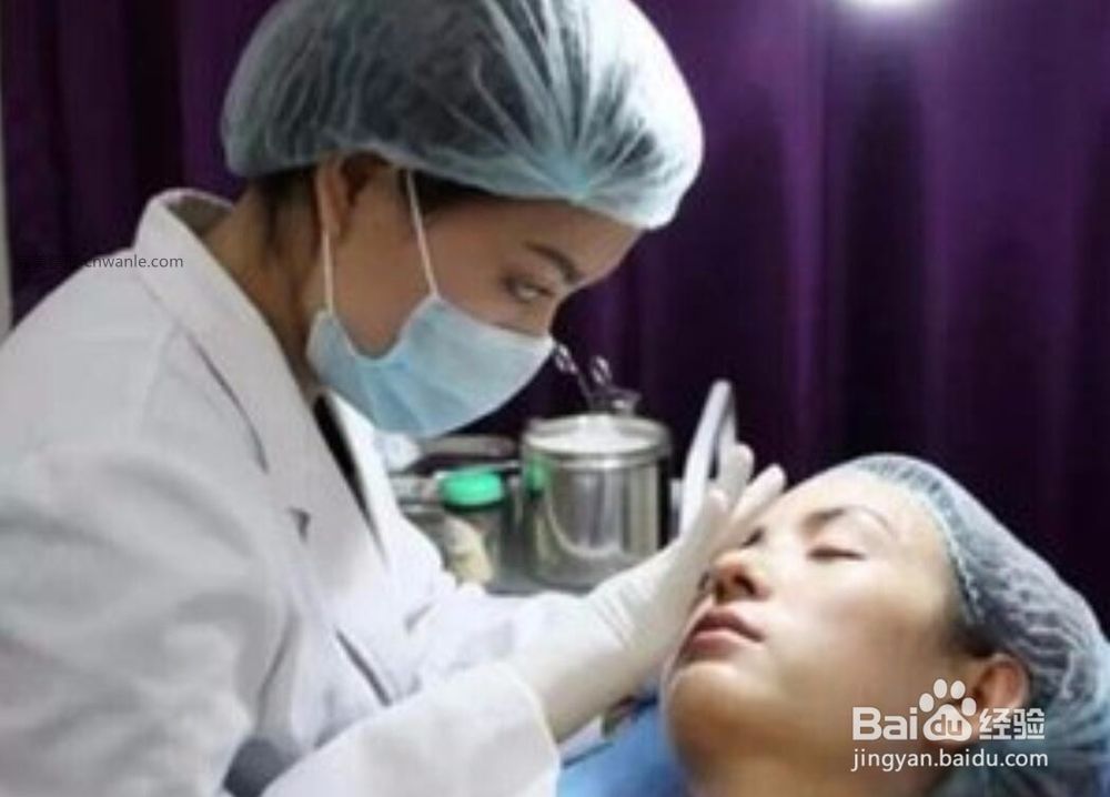 刚纹的发际线怎样去掉